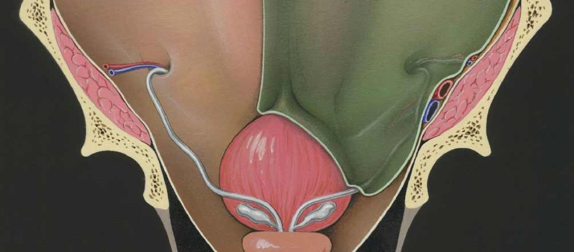 uro-illustration-prostagte
