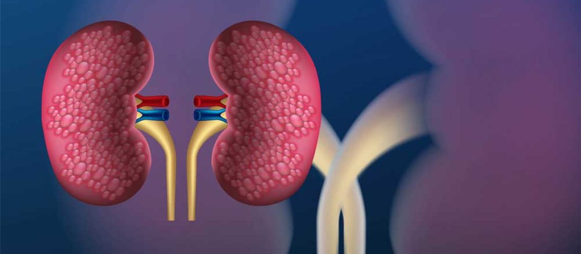 uro-reins-transplantation
