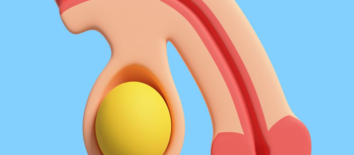 uro-testicules